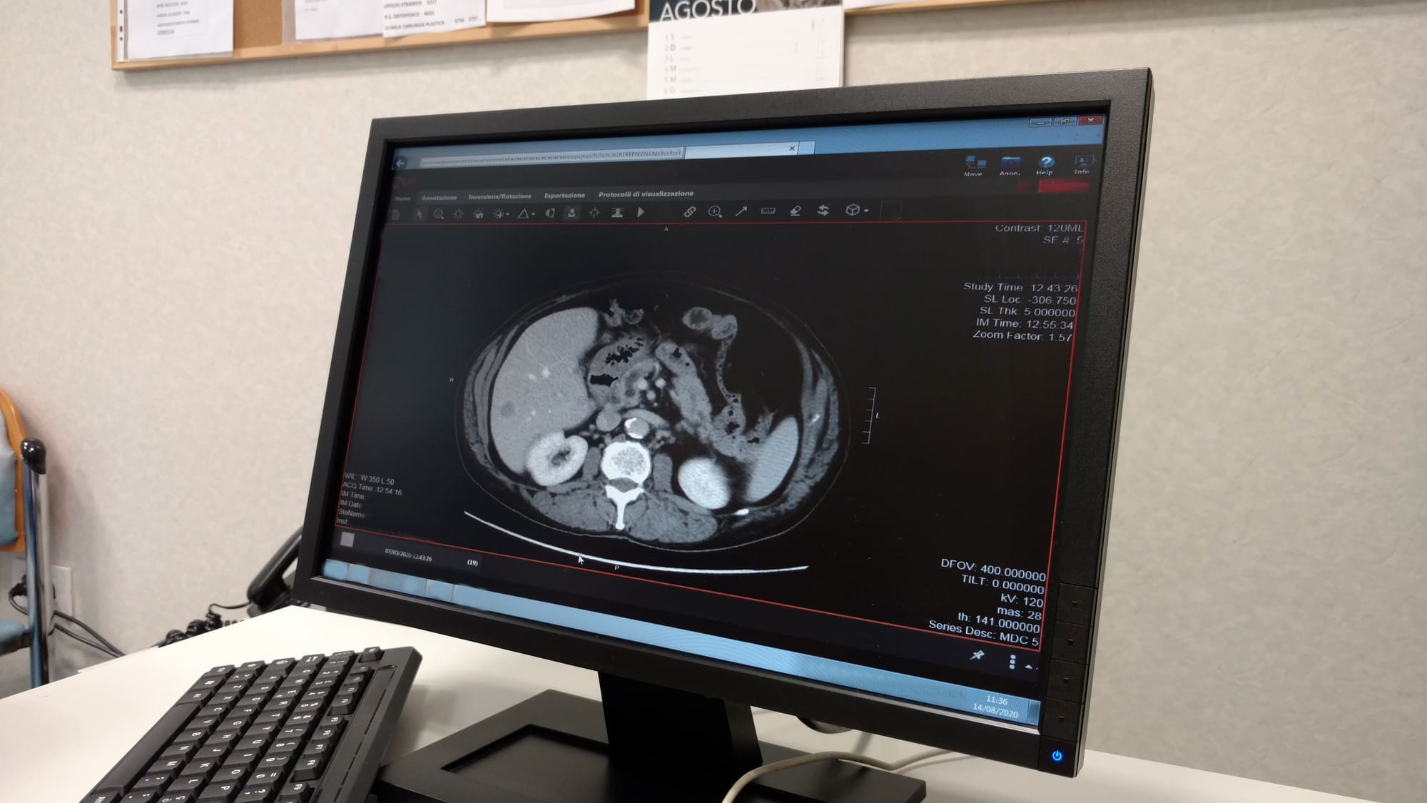 Migliorare la risoluzione dell’ecografia per migliorare la diagnosi